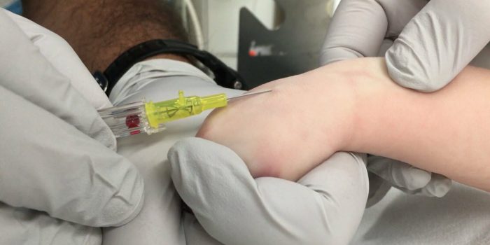 pemasangan infus bayi dan anak